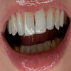 intrepidskin.bandcamp.com